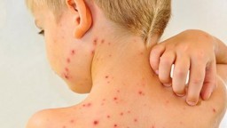 Страшная болезнь начала &laquo;косить&raquo; константиновцев