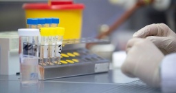 В Константиновке 8-летний ребенок заразился коронавирусом