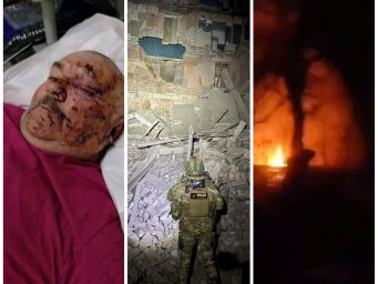 Пострадавшему в результате авиаудара в Константиновке нужна помощь